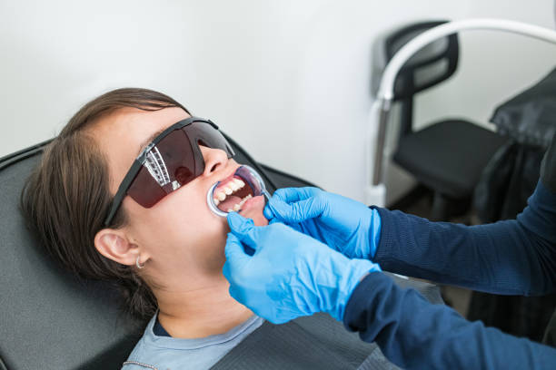 Best Teeth Whitening  in Shoh, IL