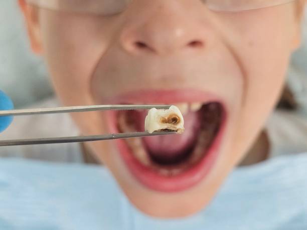 Best Emergency Pediatric Dentist  in Shoh, IL